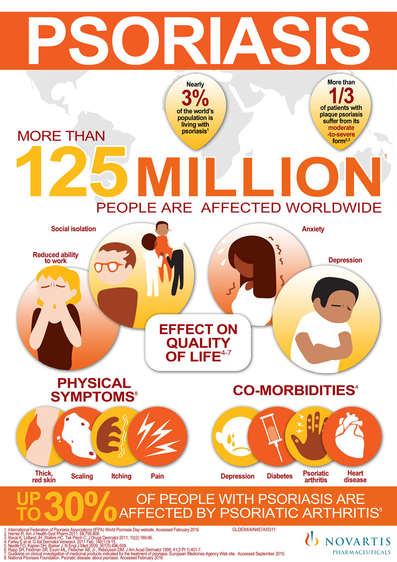 Novartis Infographic for 90TEN, centered on Psoriasis
